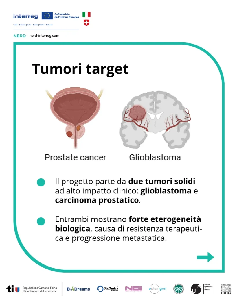 Glioblastoma e carcinoma prostatico, i due tumori studiati dal progetto NERD